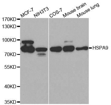 HSPA9 / Mortalin / GRP75 Antibody - Western blot analysis of extracts of various cell lines, using HSPA9 antibody at 1:500 dilution. The secondary antibody used was an HRP Goat Anti-Rabbit IgG (H+L) at 1:10000 dilution. Lysates were loaded 25ug per lane and 3% nonfat dry milk in TBST was used for blocking.