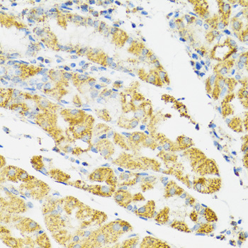 HSPA9 / Mortalin / GRP75 Antibody - Immunohistochemistry of paraffin-embedded human stomach using HSPA9 antibodyat dilution of 1:100 (40x lens).