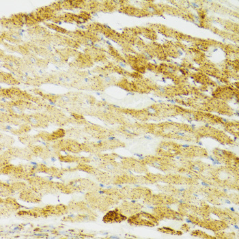 HSPA9 / Mortalin / GRP75 Antibody - Immunohistochemistry of paraffin-embedded mouse heart using HSPA9 antibodyat dilution of 1:100 (40x lens).
