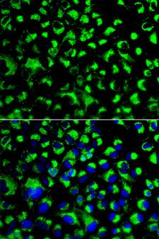 HSPA9 / Mortalin / GRP75 Antibody - Immunofluorescence analysis of U2OS cells using HSPA9 antibody. Blue: DAPI for nuclear staining.