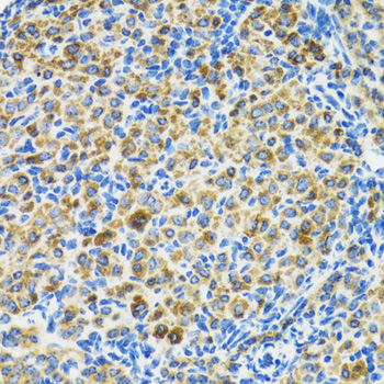 HSPA9 / Mortalin / GRP75 Antibody - Immunohistochemistry of paraffin-embedded rat ovary using HSPA9 antibodyat dilution of 1:100 (40x lens).