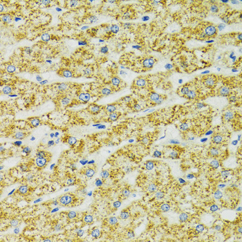 HSPA9 / Mortalin / GRP75 Antibody - Immunohistochemistry of paraffin-embedded human liver using HSPA9 antibodyat dilution of 1:100 (40x lens).