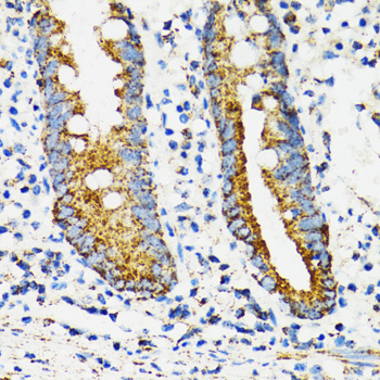 HSPA9 / Mortalin / GRP75 Antibody - Immunohistochemistry of paraffin-embedded human vermiform appendix using HSPA9 antibodyat dilution of 1:100 (40x lens).