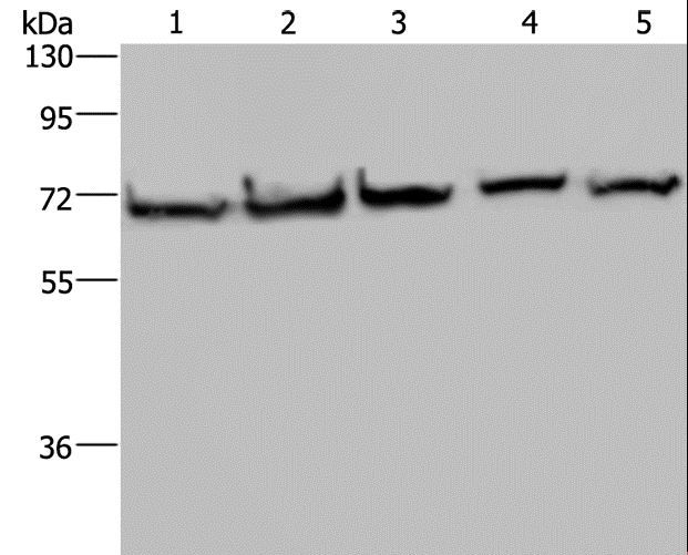 HSPA9 / Mortalin / GRP75 Antibody - Western blot analysis of HT-29, A549, 293T, MCF-7 and HeLa cell, using HSPA9 Polyclonal Antibody at dilution of 1:300.