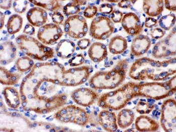 HSPA9 / Mortalin / GRP75 Antibody