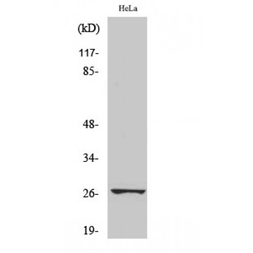 HSPB1 / HSP27 Antibody - Western blot of Phospho-HSP27 (S78) antibody