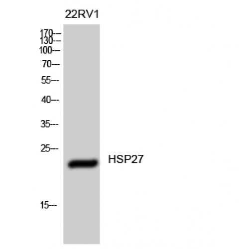 HSPB1 / HSP27 Antibody - Western blot of HSP27 antibody