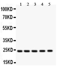 HSPB1 / HSP27 Antibody - HSP27 antibody Western blot. All lanes: Anti HSP27 at 0.5 ug/ml. Lane 1: NRK Whole Cell Lysate at 40 ug. Lane 2: HELA Whole Cell Lysate at 40 ug. Lane 3: A549 Whole Cell Lysate at 40 ug. Lane 4: COLO320 Whole Cell Lysate at 40 ug. Lane 5: HEPG2 Whole Cell Lysate at 40 ug. Predicted band size: 23 kD. Observed band size: 23 kD.