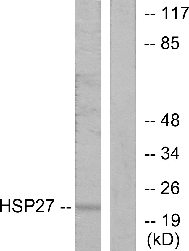 HSPB1 / HSP27 Antibody - Western blot analysis of lysates from HeLa cells, using HSP27 Antibody. The lane on the right is blocked with the synthesized peptide.