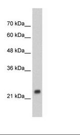 HSPB1 / HSP27 Antibody - HepG2 Cell Lysate.  This image was taken for the unconjugated form of this product. Other forms have not been tested.