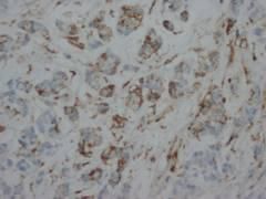 HSPB1 / HSP27 Antibody -  This image was taken for the unconjugated form of this product. Other forms have not been tested.