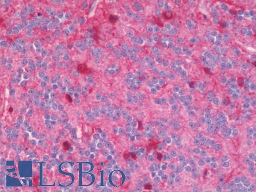 HSPB1 / HSP27 Antibody - Anti-HSPB2 / HSP27 antibody IHC staining of human brain, cerebellum. Immunohistochemistry of formalin-fixed, paraffin-embedded tissue after heat-induced antigen retrieval.  This image was taken for the unconjugated form of this product. Other forms have not been tested.