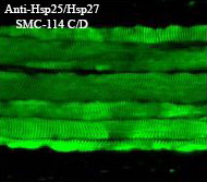 HSPB1 / HSP27 Antibody - Hsp25-Hsp27 (8A7), Mouse epidermis, muscle.  This image was taken for the unconjugated form of this product. Other forms have not been tested.
