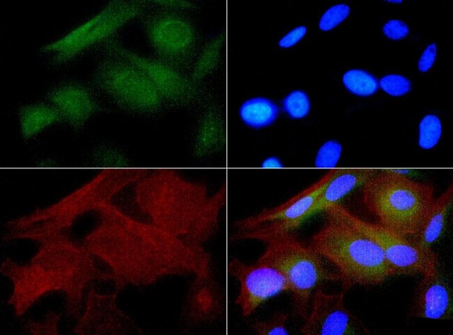 HSPB1 / HSP27 Antibody - Immunocytochemistry/Immunofluorescence: Hsp27 Antibody - HSP27 antibody was tested in HeLa cells with FITC (green). Nuclei and actin were counterstained with Dapi (blue) and Phalloidin (red).  This image was taken for the unconjugated form of this product. Other forms have not been tested.