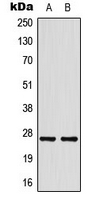 HSPB1 / HSP27 Antibody - Western blot analysis of HSP27 expression in HeLa (A); HepG2 (B) whole cell lysates.