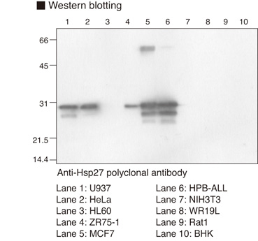 HSPB1 / HSP27 Antibody
