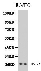 HSPB1 / HSP27 Antibody - Western blot of HSPB1::[Character 88]Hsp27) pAb in extracts from HUVEC cells.