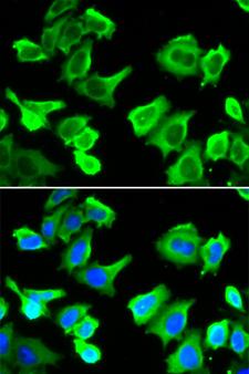 HSPB1 / HSP27 Antibody - Immunofluorescence analysis of A549 cells.