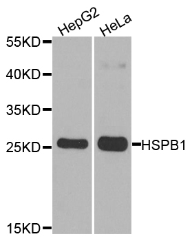 HSPB1 / HSP27 Antibody - Western blot analysis of extracts of various cell lines, using HSPB1 antibody at 1:1000 dilution. The secondary antibody used was an HRP Goat Anti-Rabbit IgG (H+L) at 1:10000 dilution. Lysates were loaded 25ug per lane and 3% nonfat dry milk in TBST was used for blocking. An ECL Kit was used for detection and the exposure time was 90s.