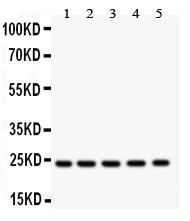 HSPB1 / HSP27 Antibody - Western blot testing of HSP27 antibody and Lane 1: NRK; 2: HeLa; 3: A549; 4: COLO320; 5: HEPG2 lysate