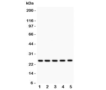 HSPB1 / HSP27 Antibody - Western blot testing of HSP27 antibody and Lane 1: rat NRK; 2: human HeLa; 3: (h) A549; 4: (h) COLO320; 5: (h) HEPG2 lysate. Expected size 23~27KD
