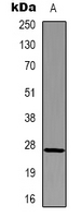 HSPB1 / HSP27 Antibody - Western blot analysis of HSP27 expression in HeLa (A) whole cell lysates.