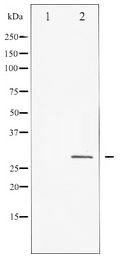HSPB1 / HSP27 Antibody - Western blot of HSP27 expression in Ca2+ treated HeLa whole cell lysates,The lane on the left is treated with the antigen-specific peptide.