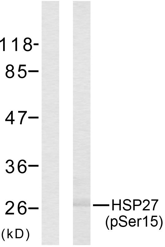 HSPB1 / HSP27 Antibody - Western blot analysis of lysates from HeLa cells treated with UV, using HSP27 (Phospho-Ser15) Antibody. The lane on the left is blocked with the phospho peptide.