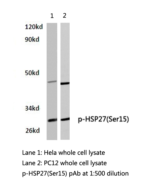 HSPB1 / HSP27 Antibody - Western blot of p-HSP27 (S15) pAb in extracts from HeLa and PC12 cells.