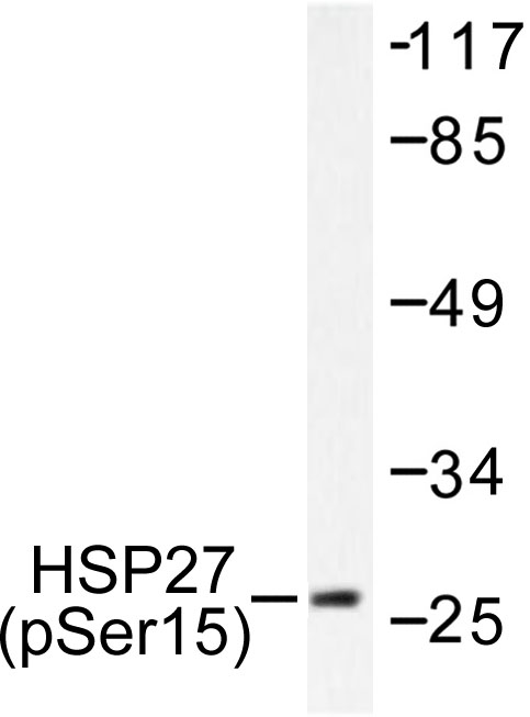 HSPB1 / HSP27 Antibody - Western blot of p-HSP27 (S15) pAb in extracts from 293 cells treated with UV.