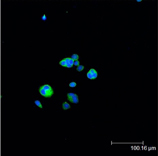 HSPB1 / HSP27 Antibody - Immunofluorescence (confocal) staining of HeLa cells using Hsp27 (pSer15) pAb (green); nuclei are stained in blue pseudocolor using DRAQ.