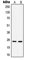 HSPB1 / HSP27 Antibody - Western blot analysis of HSP27 (pS15) expression in HeLa Anisomycin-treated (A); MCF7 (B) whole cell lysates.