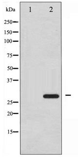 HSPB1 / HSP27 Antibody - Western blot of HSP27 phosphorylation expression in UV treated HeLa whole cell lysates,The lane on the left is treated with the antigen-specific peptide.
