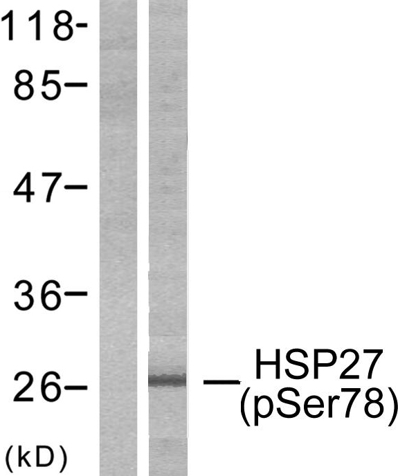 HSPB1 / HSP27 Antibody - Western blot analysis of lysates from HeLa cells treated with Ca2+, using HSP27 (Phospho-Ser78) Antibody. The lane on the left is blocked with the phospho peptide.