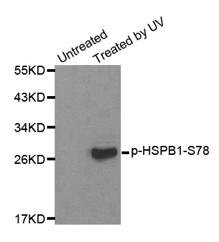 HSPB1 / HSP27 Antibody - Western blot analysis of extracts from HL60 cells.