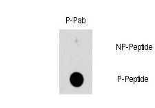 HSPB1 / HSP27 Antibody - Dot blot of Phospho-HSBP1-S78 polyclonal antibody on nitrocellulose membrane. 50ng of Phospho-peptide or Non Phospho-peptide per dot were adsorbed. Antibody working concentration was 0.5ug per ml. P-antibody: phospho-antibody; P-Peptide: phospho-peptide; NP-Peptide: non-phospho-peptide.