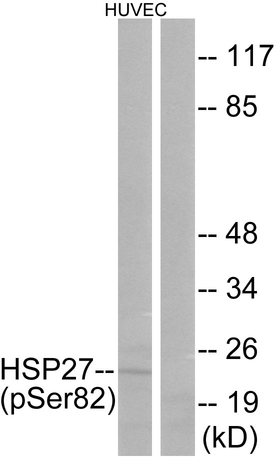 HSPB1 / HSP27 Antibody - Western blot analysis of lysates from HUVEC cells treated with TNF 20ng/ml 30', using HSP27 (Phospho-Ser82) Antibody. The lane on the right is blocked with the phospho peptide.