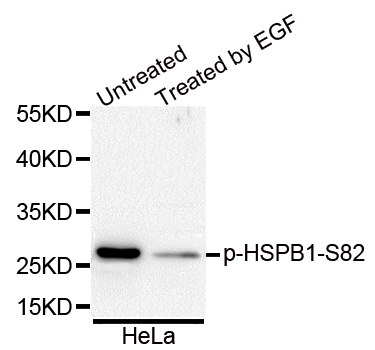 HSPB1 / HSP27 Antibody - Western blot analysis of extracts of HeLa cells.