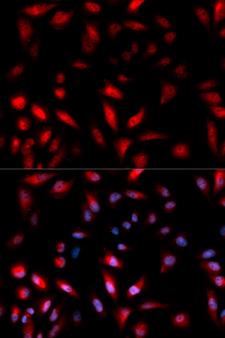 HSPB1 / HSP27 Antibody - Immunofluorescence analysis of U2OS cells.
