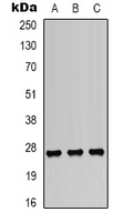 HSPB1 / HSP27 Antibody - Western blot analysis of HSP27 (pS82) expression in A549 (A); HepG2 (B); K562 (C) whole cell lysates.