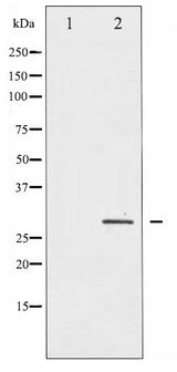 HSPB1 / HSP27 Antibody - Western blot of HSP27 phosphorylation expression in Ca2+ treated HeLa whole cell lysates,The lane on the left is treated with the antigen-specific peptide.