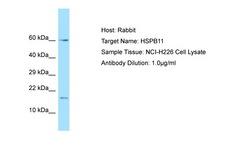 HSPB11 Antibody -  This image was taken for the unconjugated form of this product. Other forms have not been tested.