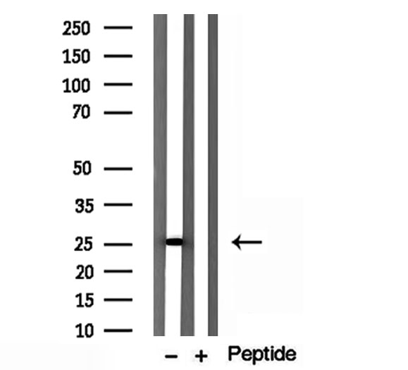 HSPB11 Antibody - Western blot analysis of extracts of mouse brain tissue using IFT25 antibody.