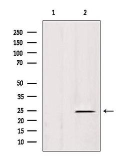 HSPB11 Antibody - Western blot analysis of extracts of rat spleen using IFT25 antibody. Lane 1 was treated with the blocking peptide.