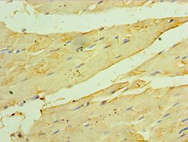 HSPB2 / HSP27 Antibody - Immunohistochemistry of paraffin-embedded human skeletal muscle using antibody at 1:100 dilution.