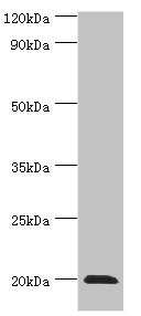 HSPB2 / HSP27 Antibody - Western blot All lanes: Heat shock protein beta-2 antibody at 3µg/ml + Mouse skeletal muscle tissue Secondary Goat polyclonal to rabbit IgG at 1/10000 dilution Predicted band size: 20 kDa Observed band size: 20 kDa