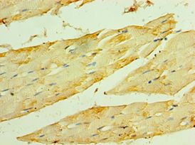 HSPB2 / HSP27 Antibody - Immunohistochemistry of paraffin-embedded human skeletal muscle using antibody at 1:100 dilution.
