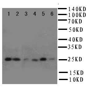 HSPB2 / HSP27 Antibody - WB of HSPB2 / HSP27 antibody. Lane 1: Rat Liver Tissue Lysate. Lane 2: Rat Spleen Tissue Lysate. Lane 3: HELA Cell Lysate. Lane 4: COLO320 Cell Lysate. Lane 5: HT1080 Cell Lysate. Lane 6: MCF-7 Cell Lysate.