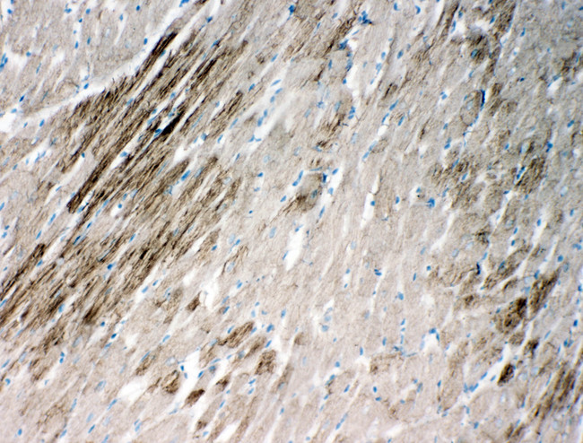 HSPB2 / HSP27 Antibody - HSPB2 / HSP27 antibody. IHC(F): Rat Cardiac Muscle Tissue.