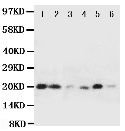 HSPB2 / HSP27 Antibody - Anti-HSPB2 antibody, Western blotting All lanes: Anti HSPB2 at 0.5ug/ml Lane 1: Rat Liver Tissue Lysate at 50ug Lane 2: Rat Spleen Tissue Lysate at 50ug Lane 3: HELA Whole Cell Lysate at 40ug Lane 4: COLO320 Whole Cell Lysate at 40ug Lane 5: HT1080 Whole Cell Lysate at 40ug Lane 6: MCF-7 Whole Cell Lysate at 40ug Predicted bind size: 20KD Observed bind size: 20KD